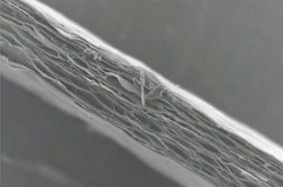 压电驻极体技术